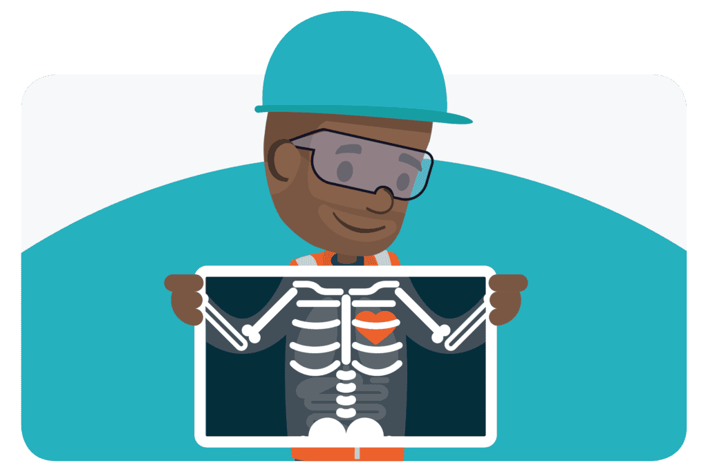 A person holding up a chest xray in front of them